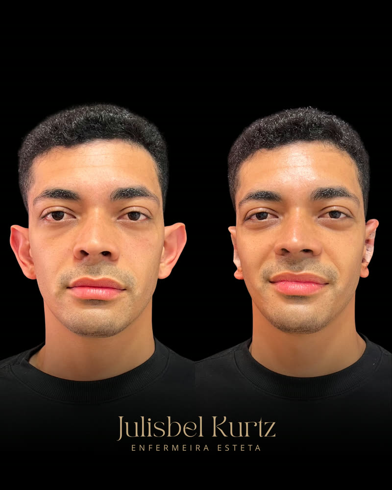 Caso real 1, antes e depois