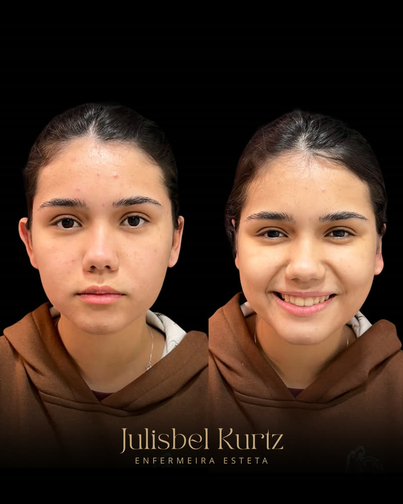 Caso real 2, antes e depois