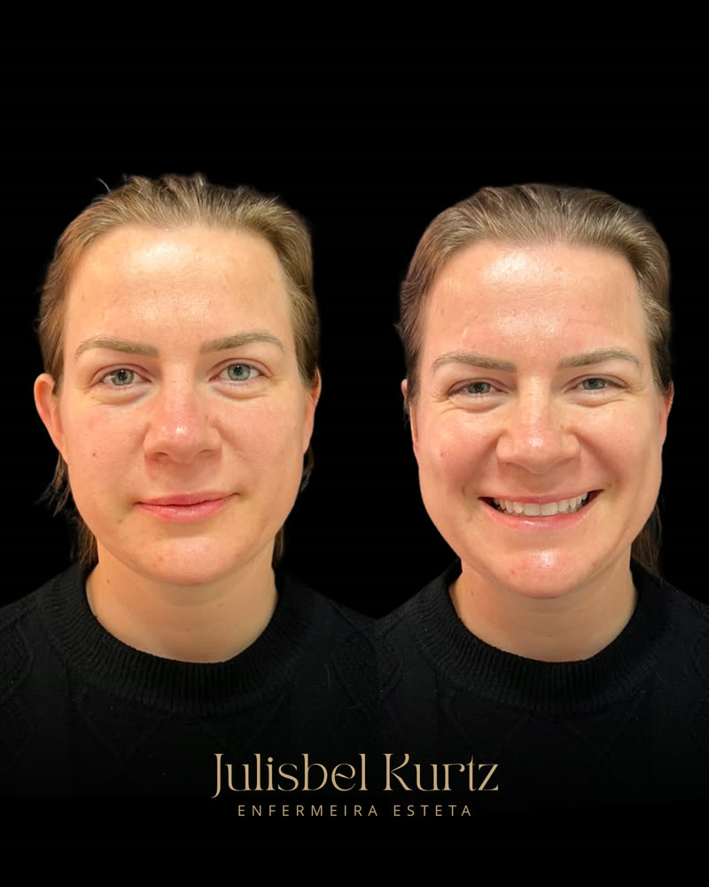Caso real 3, antes e depois