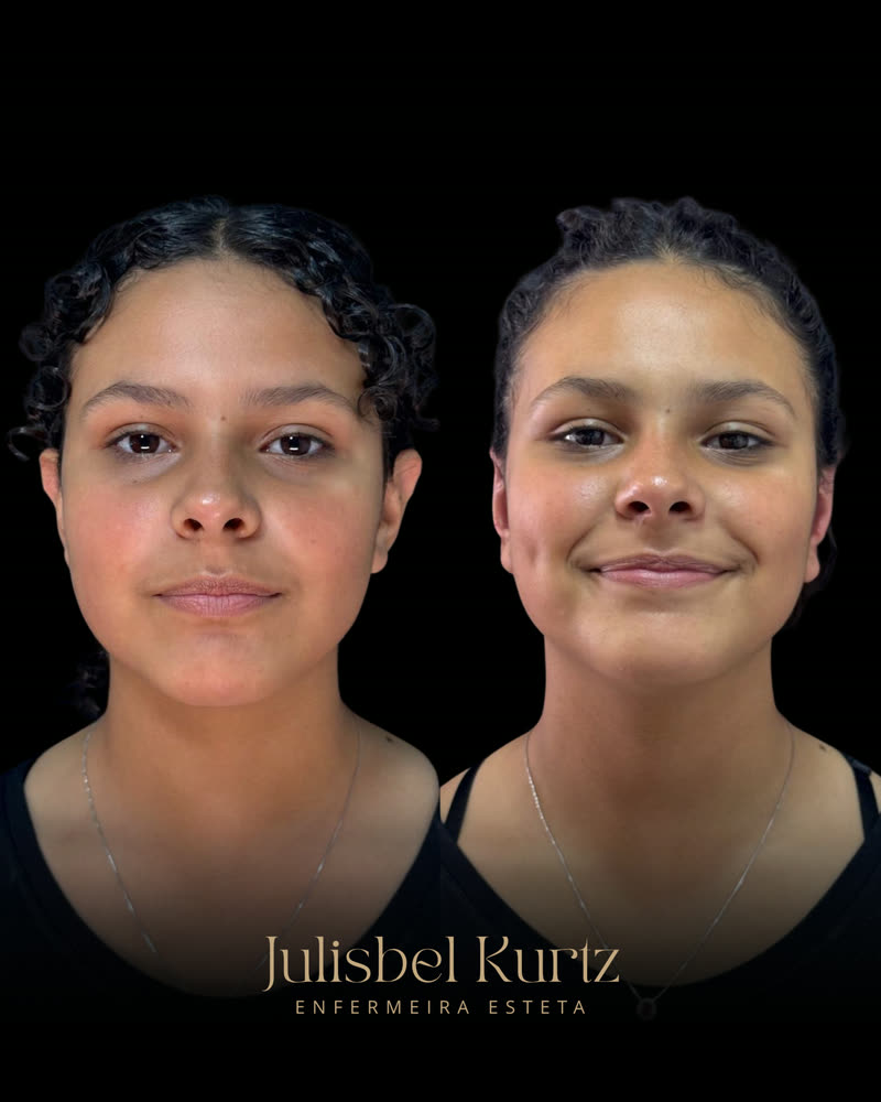 Caso real 4, antes e depois